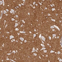 Complement Factor MASP3/MASP1 Antibody, Novus Biologicals:Antibodies:Primary