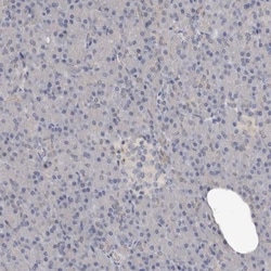 Complement Factor MASP3/MASP1 Antibody, Novus Biologicals:Antibodies:Primary