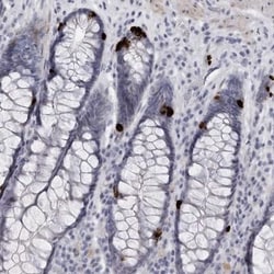 Pregnancy Zone Protein Antibody, Novus Biologicals:Antibodies:Primary Antibodies