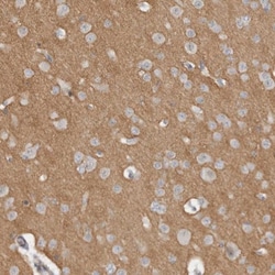 Pregnancy Zone Protein Antibody, Novus Biologicals:Antibodies:Primary Antibodies
