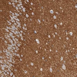 Tenascin R Antibody, Novus Biologicals 0.1mL; Unlabeled:Antibodies, Polyclonal
