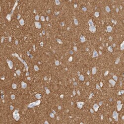 Tenascin R Antibody, Novus Biologicals 0.1mL; Unlabeled:Antibodies, Polyclonal