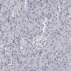 Tenascin R Antibody, Novus Biologicals 0.1mL; Unlabeled:Antibodies, Polyclonal