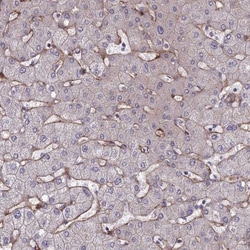 Tensin 1 Antibody, Novus Biologicals 0.1mL; Unlabeled:Antibodies, Polyclonal