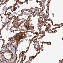 Tensin 1 Antibody, Novus Biologicals 0.1mL; Unlabeled:Antibodies, Polyclonal