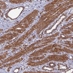 Tensin 1 Antibody, Novus Biologicals 0.1mL; Unlabeled:Antibodies, Polyclonal