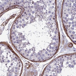 Tensin 1 Antibody, Novus Biologicals 0.1mL; Unlabeled:Antibodies, Polyclonal