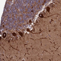 Testican 2/SPOCK2 Antibody, Novus Biologicals:Antibodies:Primary Antibodies