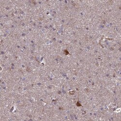 Testican 2/SPOCK2 Antibody, Novus Biologicals:Antibodies:Primary Antibodies