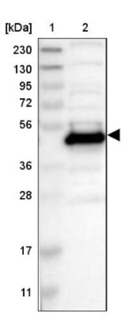 Testin Antibody, Novus Biologicals:Antibodies:Primary Antibodies