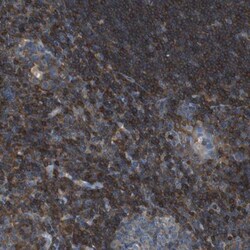 Testin Antibody, Novus Biologicals:Anticorps:Anticorps primaires