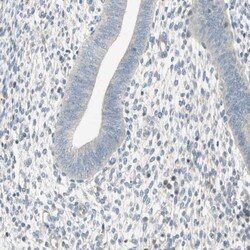 anti-Testisin/Prss21, Polyclonal, Novus Biologicals 0.1mL; Unlabeled:Antibodies,