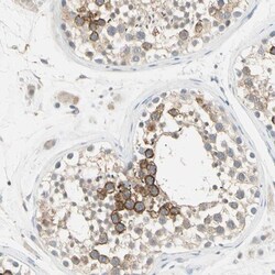 anti-Testisin/Prss21, Polyclonal, Novus Biologicals 0.1mL; Unlabeled:Antibodies,