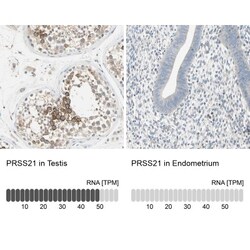 anti-Testisin/Prss21, Polyclonal, Novus Biologicals 0.1mL; Unlabeled:Antibodies,