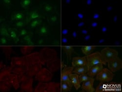 TfR (Transferrin R) Antibody (OX26) - BSA Free, Novus Biologicals 0.1mg;