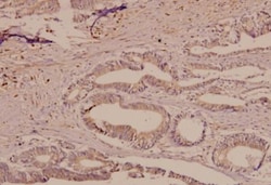 TfR (Transferrin R) Antibody - BSA Free, Novus Biologicals 0.1 mL | Buy Online | Novus Biologicals | Fisher Scientific
