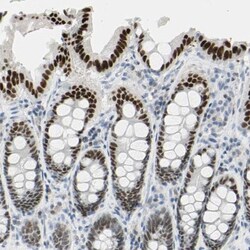 Th-POK Antibody, Novus Biologicals 25 &mu;L; Unlabeled:Antibodies, Polyclonal