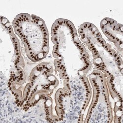 Th-POK Antibody, Novus Biologicals 0.1mL; Unlabeled:Antibodies, Polyclonal