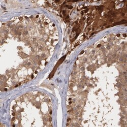 Thioredoxin Reductase 1/TRXR1 Antibody, Novus Biologicals:Antibodies:Primary