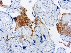 Thrombospondin-1 Antibody (A6.1), Novus Biologicals 0.25mL; Unlabeled:Antibodies,