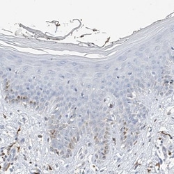 Thromboxane synthase Antibody, Novus Biologicals:Antibodies:Primary Antibodies