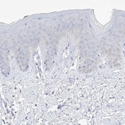 Thromboxane synthase Antibody, Novus Biologicals 25 &mu;L, Unlabeled:Antibodies,