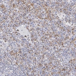 Thromboxane synthase Antibody, Novus Biologicals 25 &mu;L, Unlabeled:Antibodies,