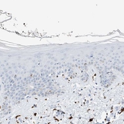 Thromboxane synthase Antibody, Novus Biologicals:Antibodies:Primary Antibodies
