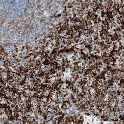 Thromboxane synthase Antibody, Novus Biologicals:Antibodies:Primary Antibodies
