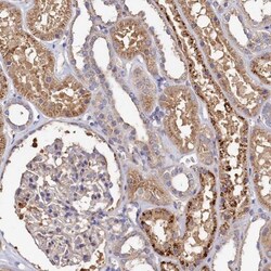 Thymidine Kinase 2 Antibody, Novus Biologicals 25 &mu;L | Buy Online | Novus Biologicals | Fisher Scientific