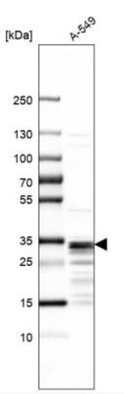 Thymidine Kinase 2 Antibody, Novus Biologicals 25 &mu;L | Buy Online | Novus Biologicals | Fisher Scientific