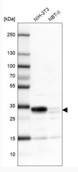 Thymidine Kinase 2 Antibody, Novus Biologicals 25 &mu;L | Buy Online | Novus Biologicals | Fisher Scientific