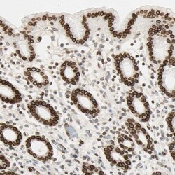 Thymopoietin/LAP2 Antibody, Novus Biologicals 0.1mL; Unlabeled:Antibodies,