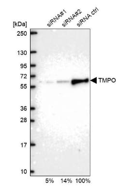 Thymopoietin/LAP2 Antibody, Novus Biologicals 0.1mL; Unlabeled:Antibodies,