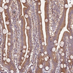 Thymosin alpha 1 Antibody, Novus Biologicals:Antikörper:Primärantikörper