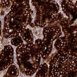 Thyroglobulin Antibody (CL0164), Novus Biologicals 0.1mL; Unlabeled:Antibodies,