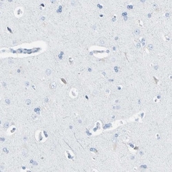 Thyroid Peroxidase Antibody, Novus Biologicals 0.1mL; Unlabeled:Antibodies,