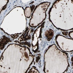 Thyroid Peroxidase Antibody, Novus Biologicals 0.1mL; Unlabeled:Antibodies,