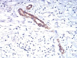 TSH beta Antibody (1D12G1) - BSA Free, Novus Biologicals 0.1mg; Unlabeled:Antibodies,