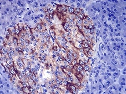 TSH beta Antibody (1D12G1) - BSA Free, Novus Biologicals 0.1mg; Unlabeled:Antibodies,