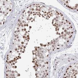 Thyroid receptor-interacting protein 12 Antibody, Novus Biologicals:Antibodies:Primary