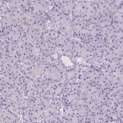 Thyroid receptor-interacting protein 13 Antibody, Novus Biologicals 0.1mL;