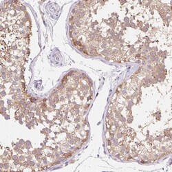 Thyroid receptor-interacting protein 13 Antibody, Novus Biologicals 0.1mL;