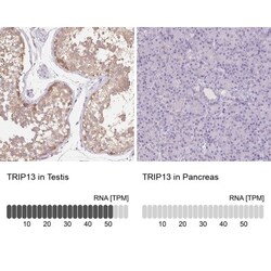 Thyroid receptor-interacting protein 13 Antibody, Novus Biologicals 0.1mL;