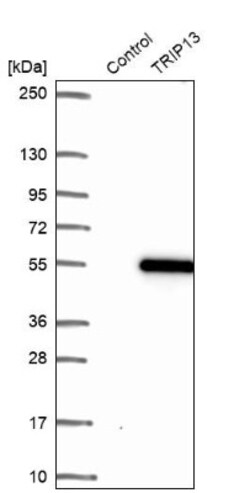 Thyroid receptor-interacting protein 13 Antibody, Novus Biologicals 0.1mL;