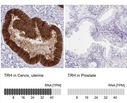 Thyrotropin Releasing Hormone Antibody, Novus Biologicals 25 &mu;L, Unlabeled:Antibodies,