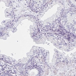 Thyrotropin Releasing Hormone Antibody, Novus Biologicals 25 &mu;L, Unlabeled:Antibodies,
