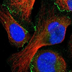 Tight Junction Protein 1 Antibody, Novus Biologicals:Antibodies:Primary