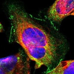 Tight Junction Protein 1 Antibody, Novus Biologicals 0.1mL; Unlabeled:Antibodies,
