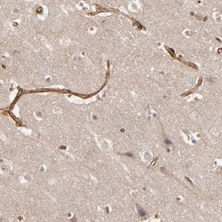Tight Junction Protein 1 Antibody, Novus Biologicals:Antibodies:Primary